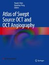 Atlas of Swept Source OCT and OCT Angiography