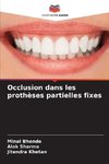 Occlusion dans les prothèses partielles fixes