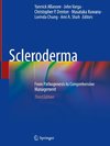 Scleroderma