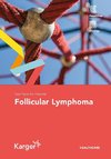 Fast Facts for Patients: Follicular Lymphoma