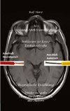 ASS Autismus-Spektrums-Segnung - Inklusion ist keine Einbahnstraße: hochfunktionaler Autismus, Mobbing, Trauma, Sucht, Häusliche Gewalt, Psychotherapie, Umzug, Inklusion, Katholische Kirche, Zen