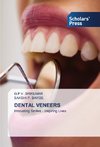 DENTAL VENEERS