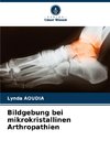 Bildgebung bei mikrokristallinen Arthropathien