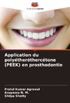 Application du polyétheréthercétone (PEEK) en prosthodontie