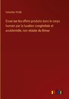 Essai sur les effets produits dans le corps humain par la luxation congénitale et accidentelle, non réduite du fémur