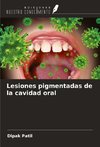 Lesiones pigmentadas de la cavidad oral