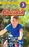 Obesidad