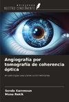 Angiografía por tomografía de coherencia óptica