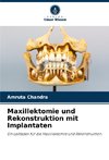 Maxillektomie und Rekonstruktion mit Implantaten