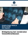 Bildgebung bei zerebralen Venenthrombosen