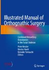 Illustrated Manual of Orthognathic Surgery