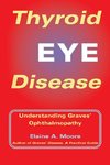 Thyroid Eye Disease