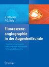 Fluoreszenzangiographie in der Augenheilkunde