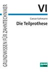 Die Teilprothese