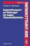 Segmenttransport am Marknagel bei langen Tibiaschaftdefekten