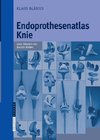 Endoprothesenatlas Knie