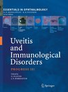 Uveitis and Immunological Disorders