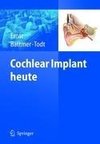 Cochlear Implant heute