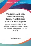 On An Epidemic Skin Disease Resembling Eczema And Pityriasis Rubra In Some Respects