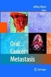 Oral Cancer Metastasis