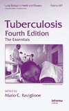 Tuberculosis