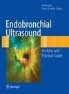 Endobronchial Ultrasound