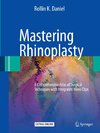 Mastering Rhinoplasty