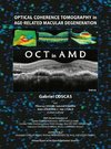 Optical Coherence Tomography in Age-Related Macular Degeneration