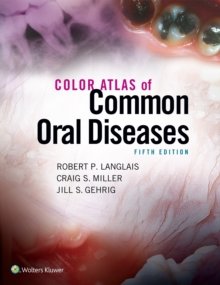 Color Atlas of Common Oral Diseases