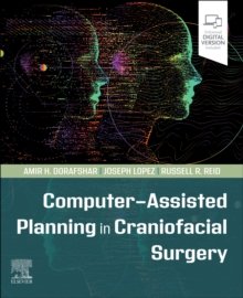 Computer-Assisted Planning in Craniofacial Surgery