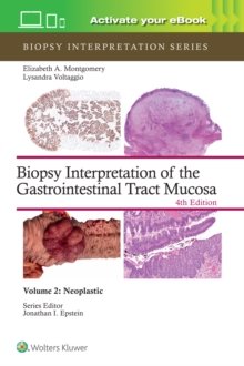 Biopsy Interpretation of the Gastrointestinal Tract Mucosa Volume 2 : Neoplastic