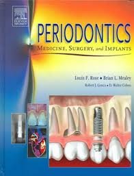 Periodontics Medicine, Surgery and Implants