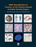  WHO Classification of Tumours of the Urinary System and Male Genital Organs