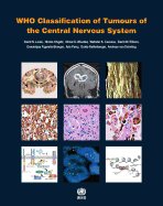 WHO Classification of Tumours of the Central Nervous System