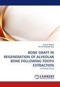 BONE GRAFT IN REGENERATION OF ALVEOLAR BONE FOLLOWING TOOTH EXTRACTION