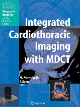 Integrated Cardiothoracic Imaging with MDCT