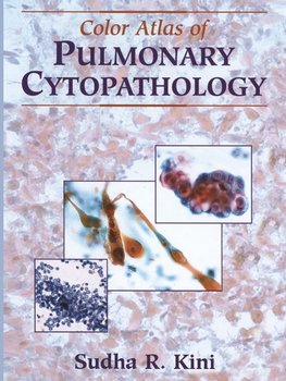 Color Atlas of Pulmonary Cytopathology