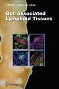 Gut-Associated Lymphoid Tissues