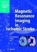 Magnetic Resonance Imaging in Ischemic Stroke