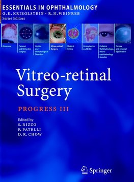 Vitreo-retinal Surgery