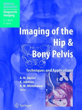 Imaging of the Hip & Bony Pelvis