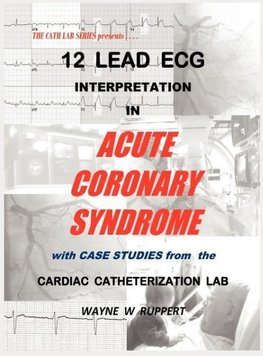 12 Lead ECG Interpretation in Acute Coronary Syndrome with Case Studies from the Cardiac Catheterization Lab