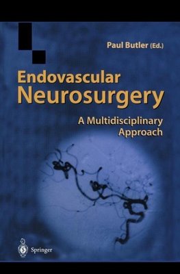 Endovascular Neurosurgery