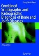 Combined Scintigraphic and Radiographic Diagnosis of Bone and Joint Diseases