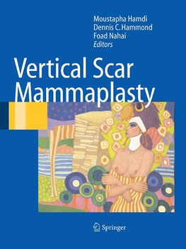 Vertical Scar Mammaplasty