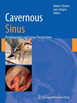 Cavernous Sinus