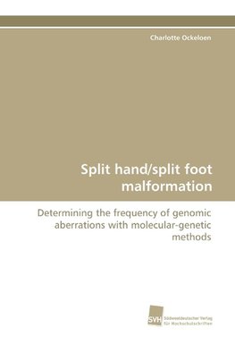 Split hand/split foot malformation