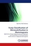 Fuzzy Classification of Microcalcification in Mammograms