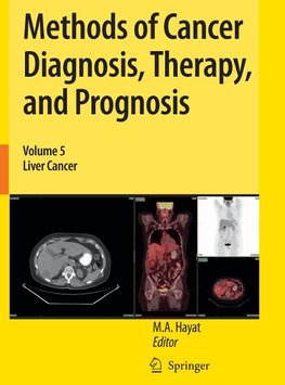 Methods of Cancer Diagnosis, Therapy, and Prognosis