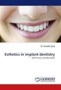 Esthetics in implant dentistry